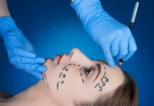 5 Things to Ensure Before Cosmetic Surgery